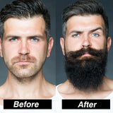 4Pcs/Set Beard Growth Kit Men Hair Enhancer Thicker