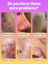 pores remover pore shrinking serum shrink Tightening Minimizing