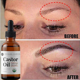 Castor Oil Prevents Hair Loss Stimulate Eyelashes Eyebrows