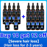 Hair growth essence can quickly grow hair and