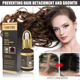 Fast Hair Growth Hair Follicle Treatment Hair Growth