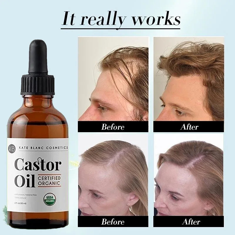 Castor Oil Prevents Hair Loss Stimulate Eyelashes Eyebrows