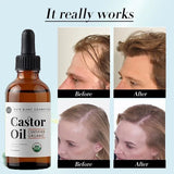 Castor Oil Prevents Hair Loss Stimulate Eyelashes Eyebrows