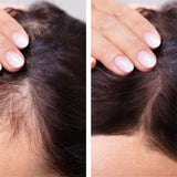 Ginger Hair Growth Product Anti-loss Hair Regrowth Serum