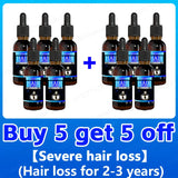 Hair growth essence can quickly grow hair and