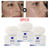 3X MANTING Mites Acarus Acari Removing Body Face