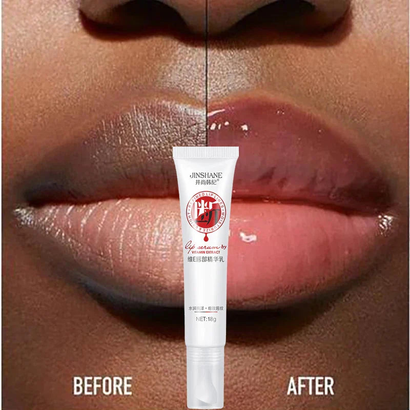 Remove Dark Lip Balm Lightening Bleaching Melanin Gloss