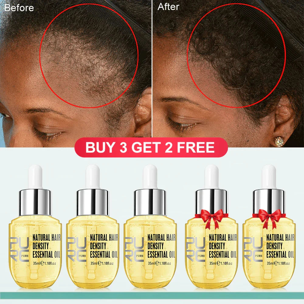 PURC Hair Growth Products for Men Women Ginger