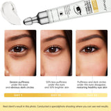 2/3/5/10 PCS Eye Cream Eye Bags Removal Under