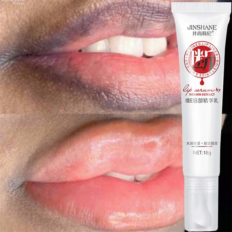 Remove Dark Lip Balm Lightening Bleaching Melanin Gloss