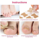 50/100pcs Ingrown Toenail Corrector Patches Nail Correction Care