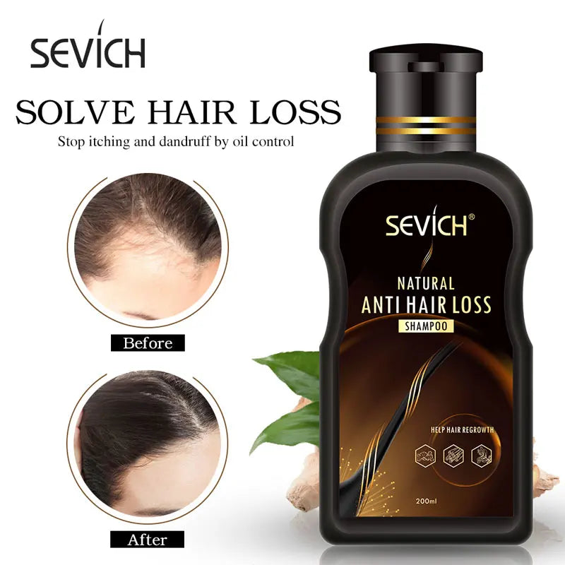 Sevich 200ml Anti Hair Loss Product Hair Loss