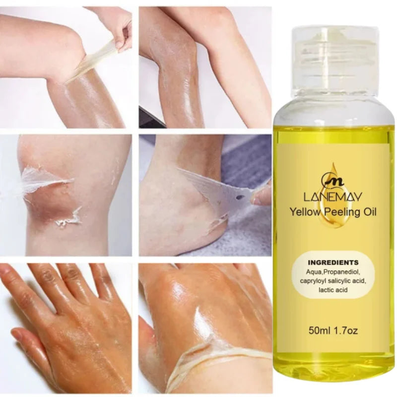 Yellow Peeling Oil Dark Skin Bleaching Remove Arm