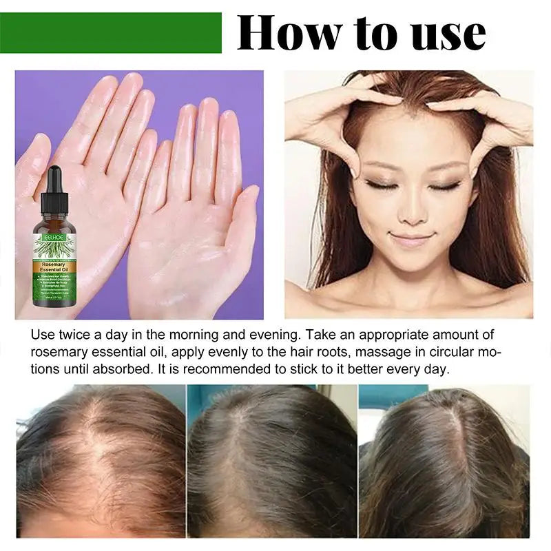 Rosemary Oil for Hair Growth Anti Hairs Loss