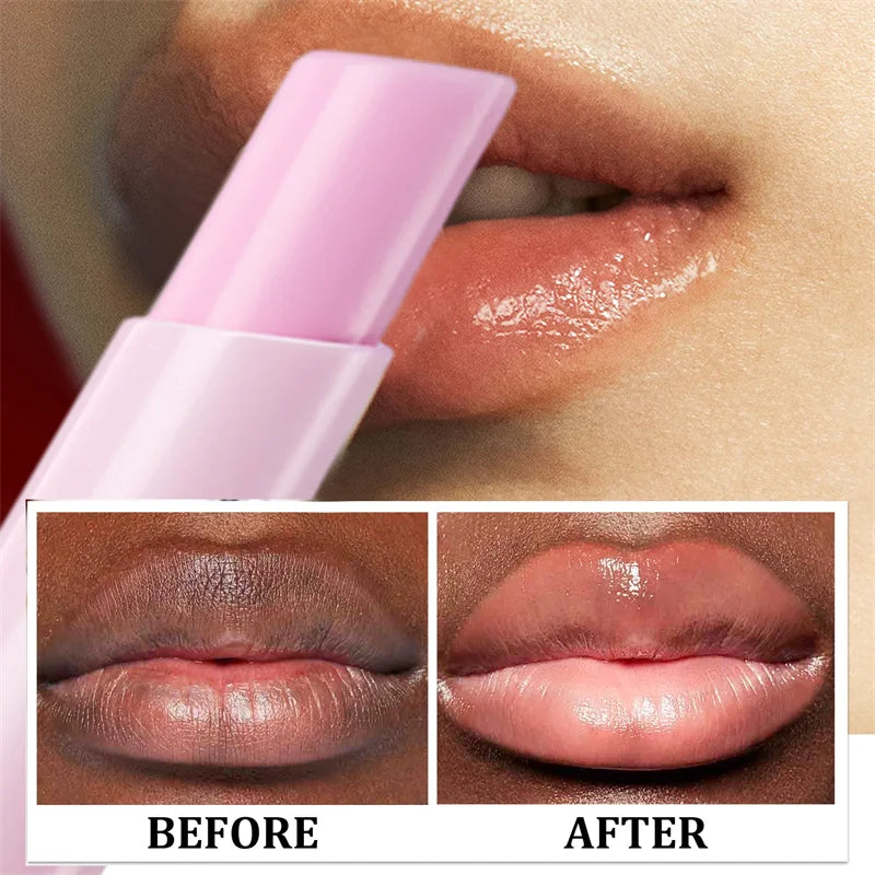 Lip Balm Remove Dark Lips Lightening Melanin Essence