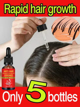 Rapid hair growth essential oil, repair baldness