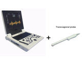 3D Based 12 Inch Notebook Black White Ultrasound