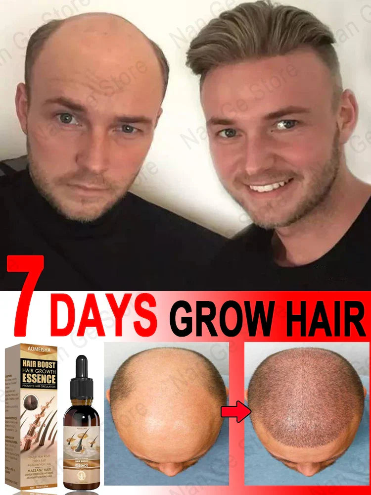 Unisex Hair Growth Oil Hair Loss Treatment Rapid