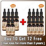 Unisex Hair Growth Oil Hair Loss Treatment Rapid