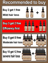 Unisex Hair Growth Oil Hair Loss Treatment Rapid