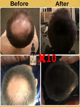 Unisex Hair Growth Oil Hair Loss Treatment Rapid